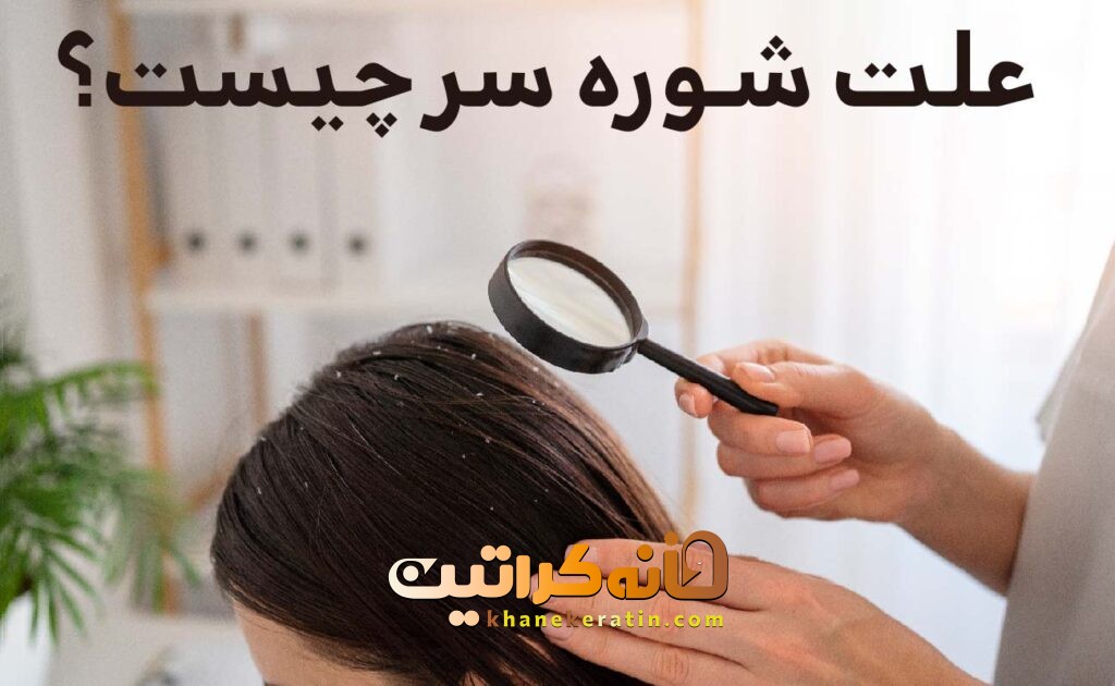 علت شوره سر چیست