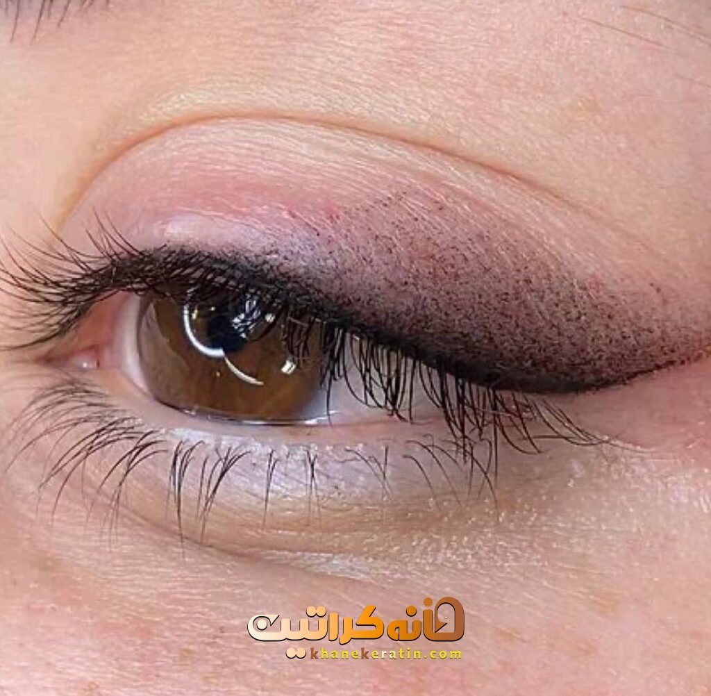 بهترین خدمات میکروبلیدینگ در ونک | بهترین مرکز فیبروز در ونک ❤️