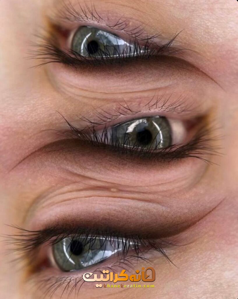 بهترین خدمات میکروبلیدینگ در پاسداران | بهترین مرکز فیبروز در پاسداران ❤️